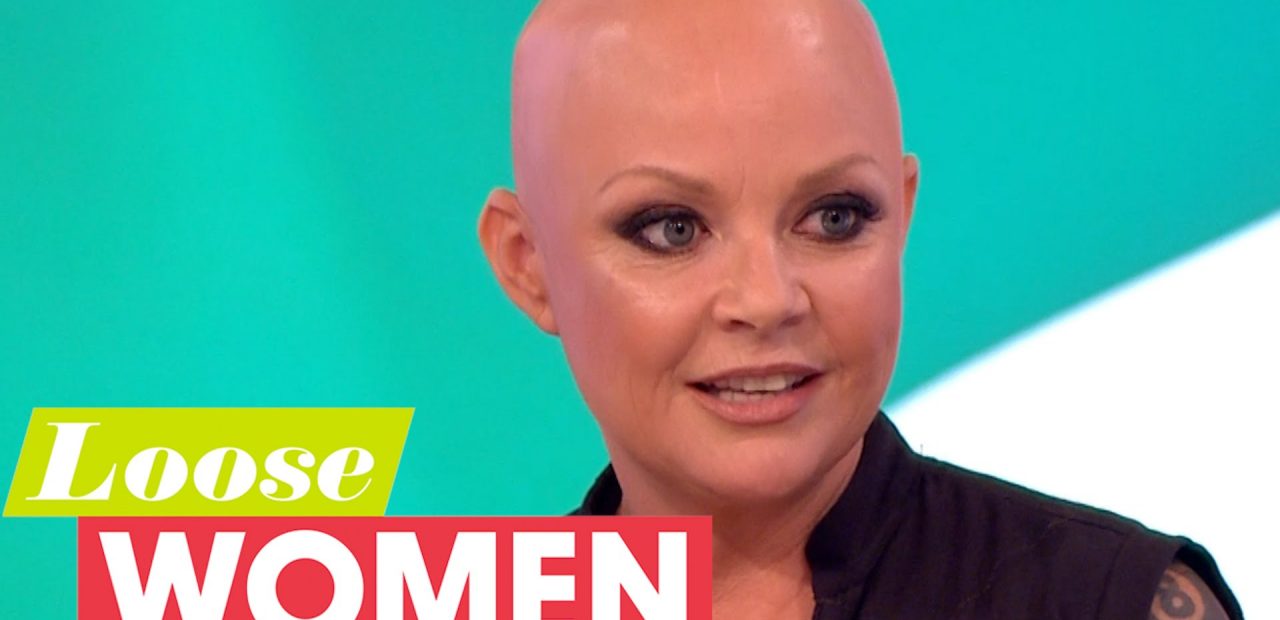 Gail Porter Female Model Tv Presenter Suffers Alopecia